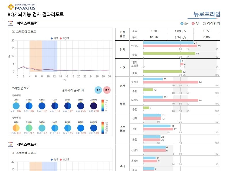 지표 분석 단계 — BQ 결과리포트 예시(개인정보 제거)